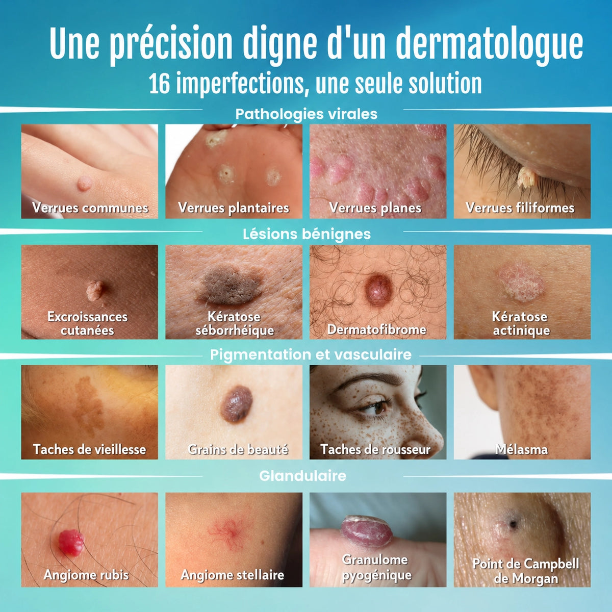 Stylo anti-imperfections avancé