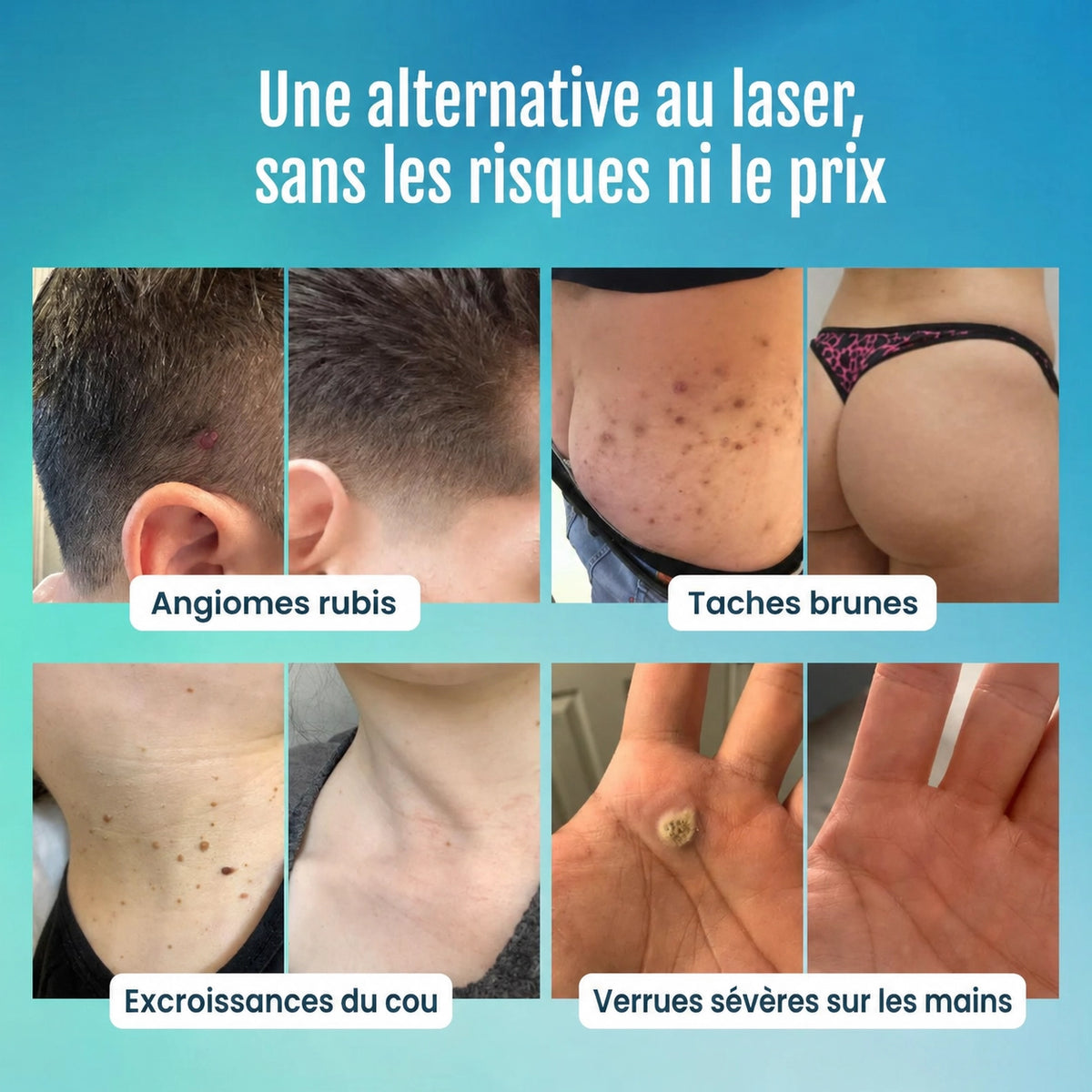 Stylo anti-imperfections avancé