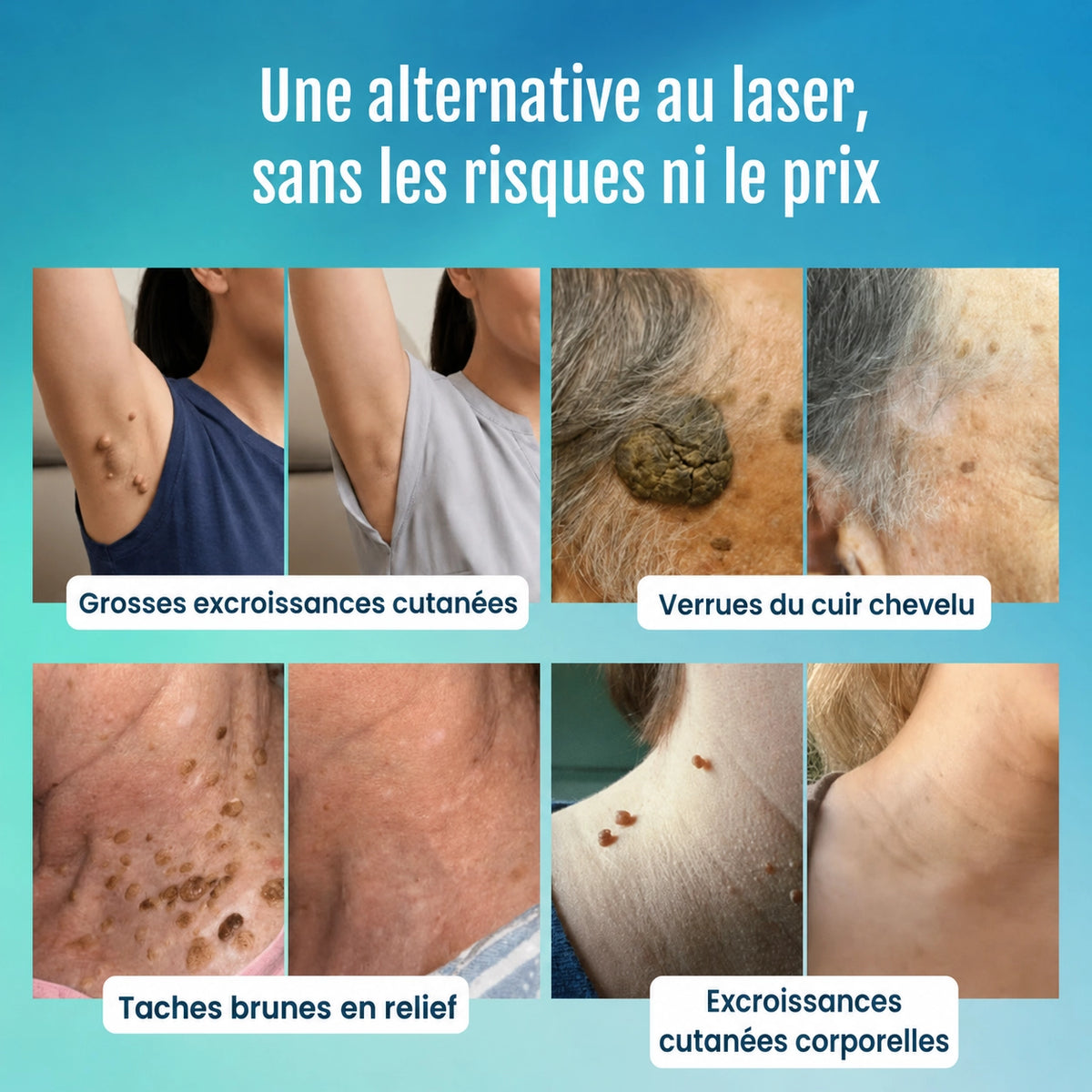 Stylo anti-imperfections avancé